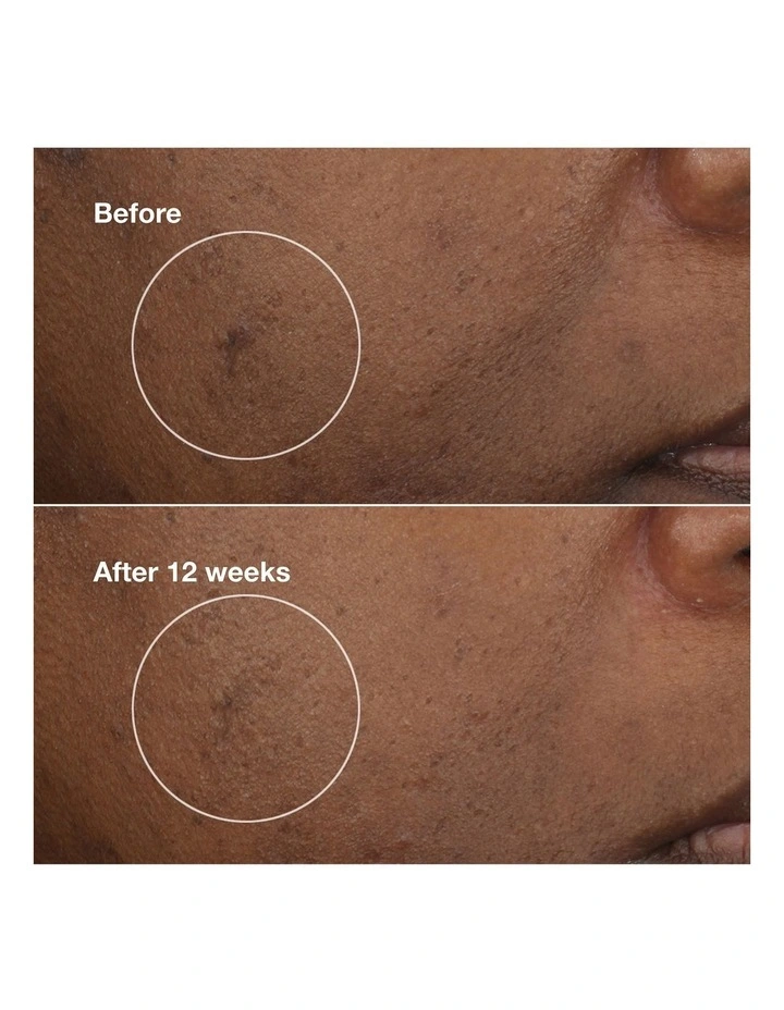 Brightening Routine: Mini Even Better Skincare Kit image 5