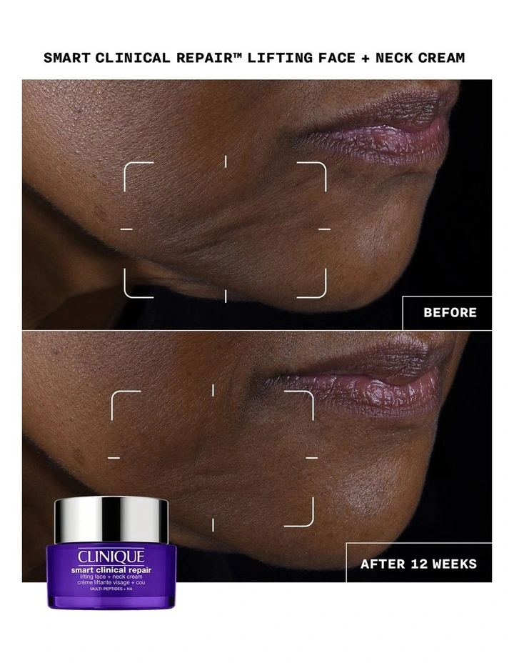 Smart Clinical Repair Lifting Face + Neck Cream image 7