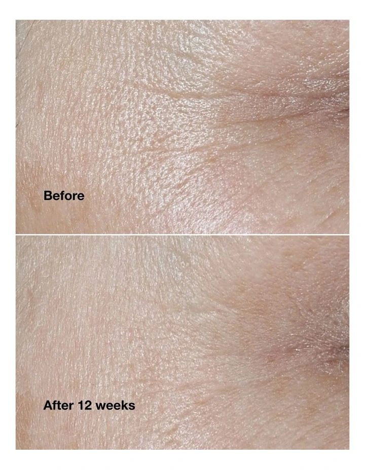 Smart Clinical Repair Wrinkle Correcting Cream For All Skin Types image 4