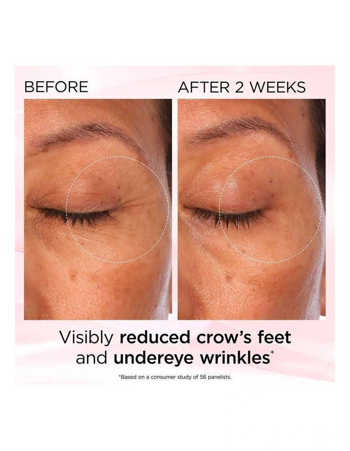 Retinol   HPR Ceramide Rapid Skin Renewing Eye Cream 15ml image 6