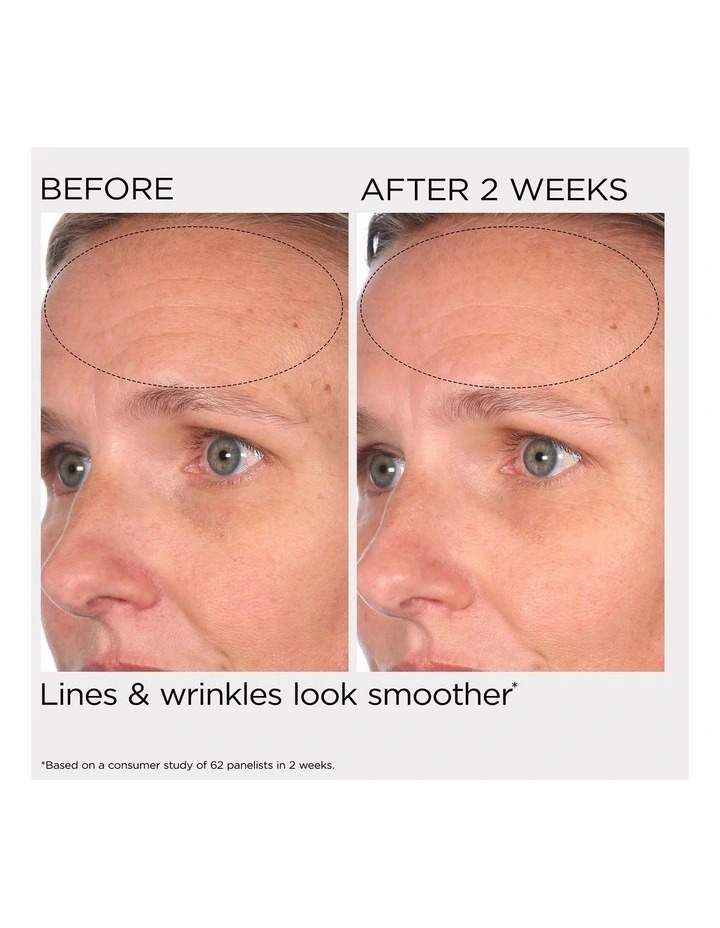 PREVAGE® Day/Night Set image 5