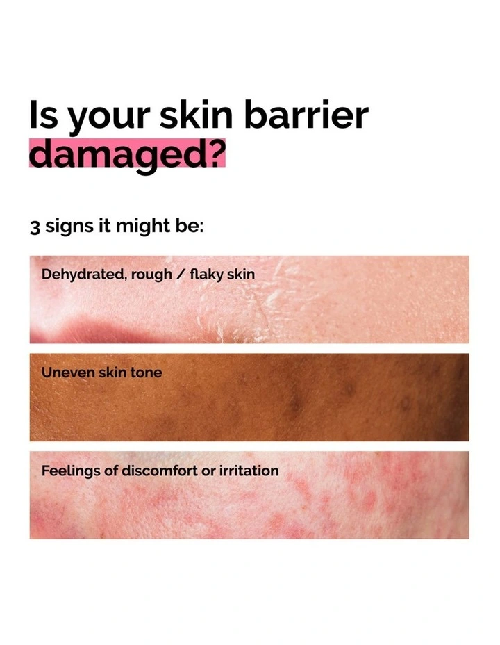 Soothing & Barrier Support Serum for Sensitive Skin, Hydration, Redness, Barrier Repair 30ml image 4