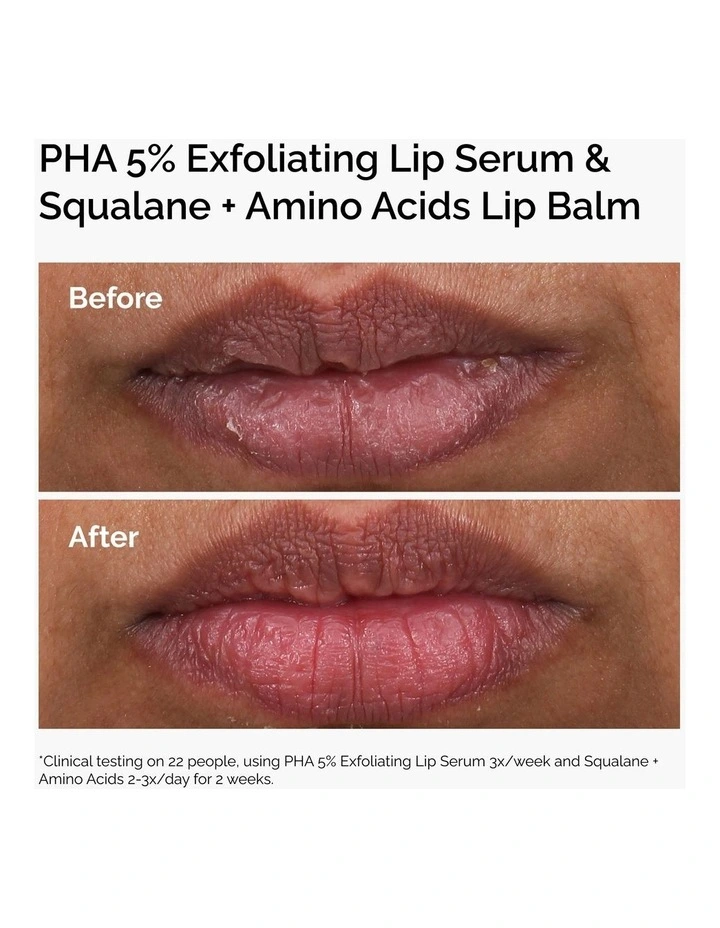 Squalane + Amino Acids Hydrating Lip Balm for Lips, Elbows and Cuticles 15ml image 4