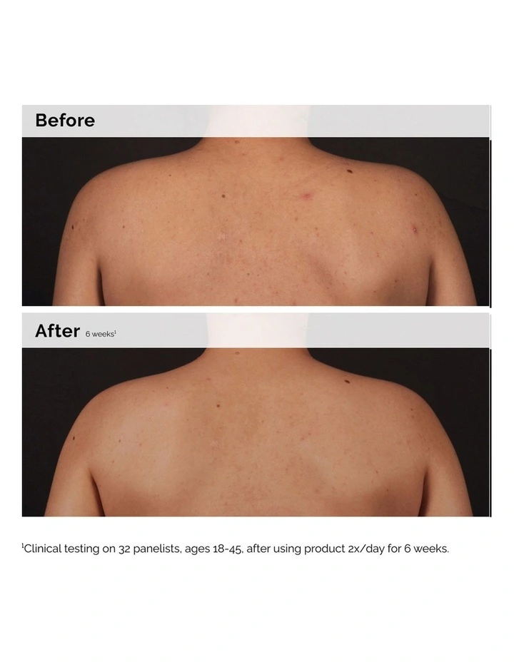 Salicylic Acid 0.5% Body Serum 240ml image 4