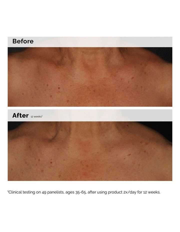Niacinamide 5% Face and Body Emulsion 100ml image 4