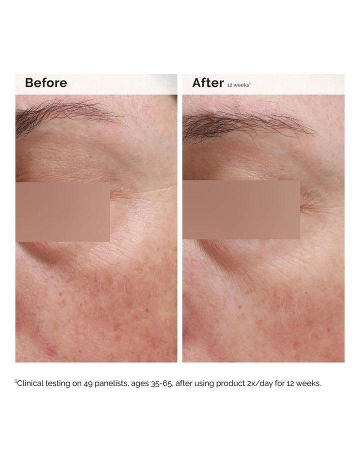 Niacinamide 5% Face and Body Emulsion 100ml image 5