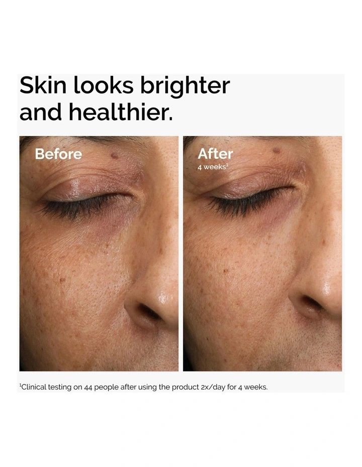 Multi-Antioxidant Radiance Serum with Vitamin C for Brightening and Antioxidant Support 30ml image 4