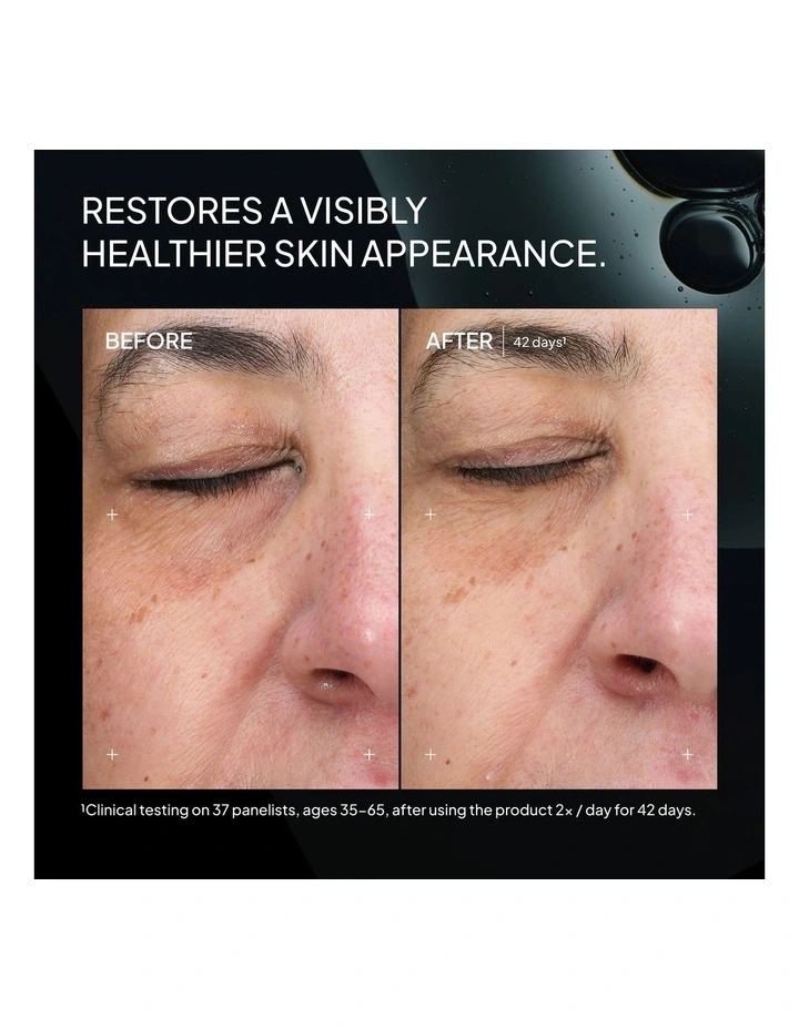 Superoxide Dismutase 3 Enzyme Mist (SDEM3) image 3