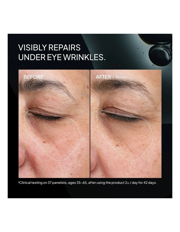 Superoxide Dismutase 3 Enzyme Mist (SDEM3) image 4