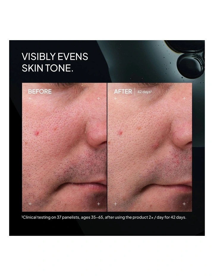 Superoxide Dismutase 3 Enzyme Mist (SDEM3) image 5