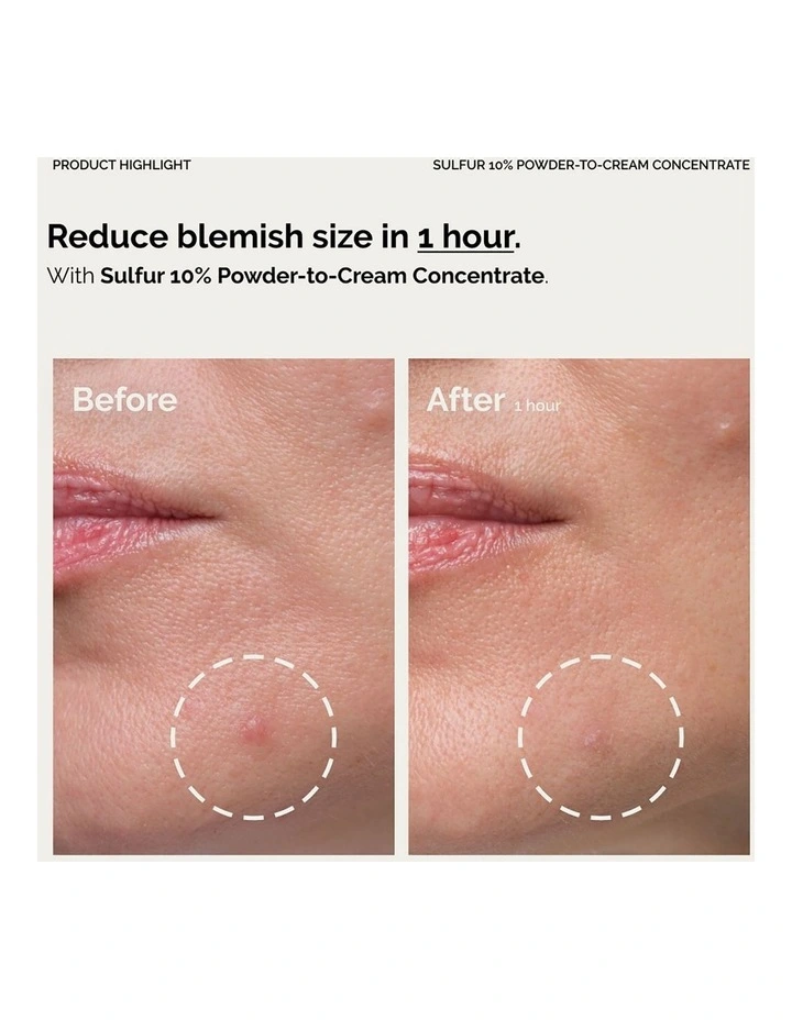 Sulfur 10% Powder-to-Cream Concentrate Fast-Acting Spot Solution for Blemish-Prone Skin 5g image 3