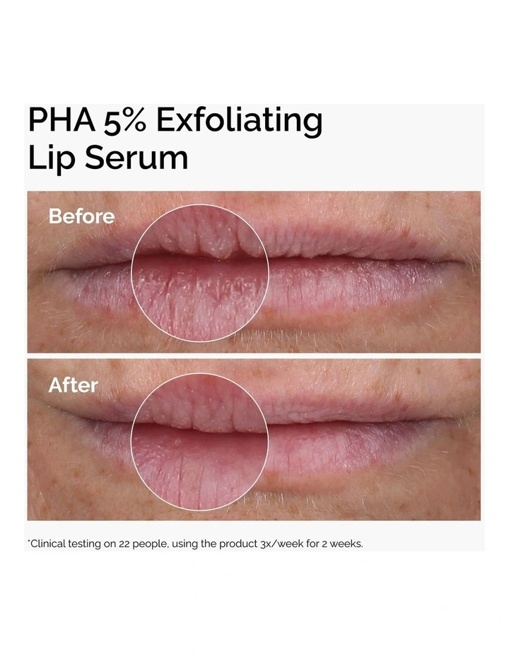 PHA 5% Lip Exfoliating Sreum image 3