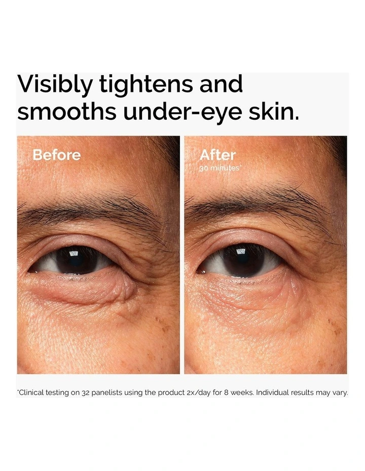 Lacto-PDRN* 4%   B9 Eye Cream image 3