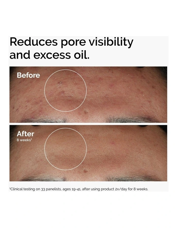 Niacinamide 10% Zinc 1% image 4