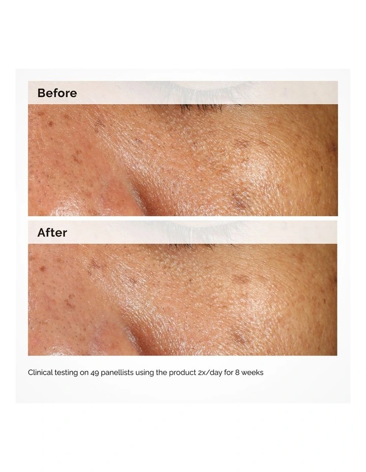 Alpha Arbutin 2% HA Hyperpigmentation Serum image 4