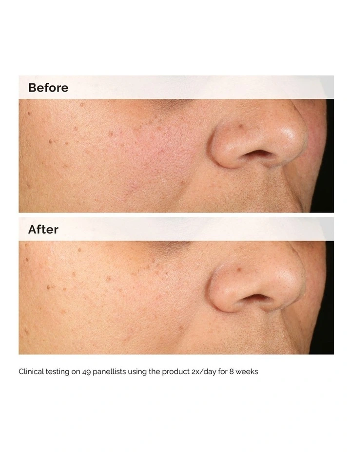 Alpha Arbutin 2% Hyaluronic Acid for Brightening and Dark Spots 30ml image 4