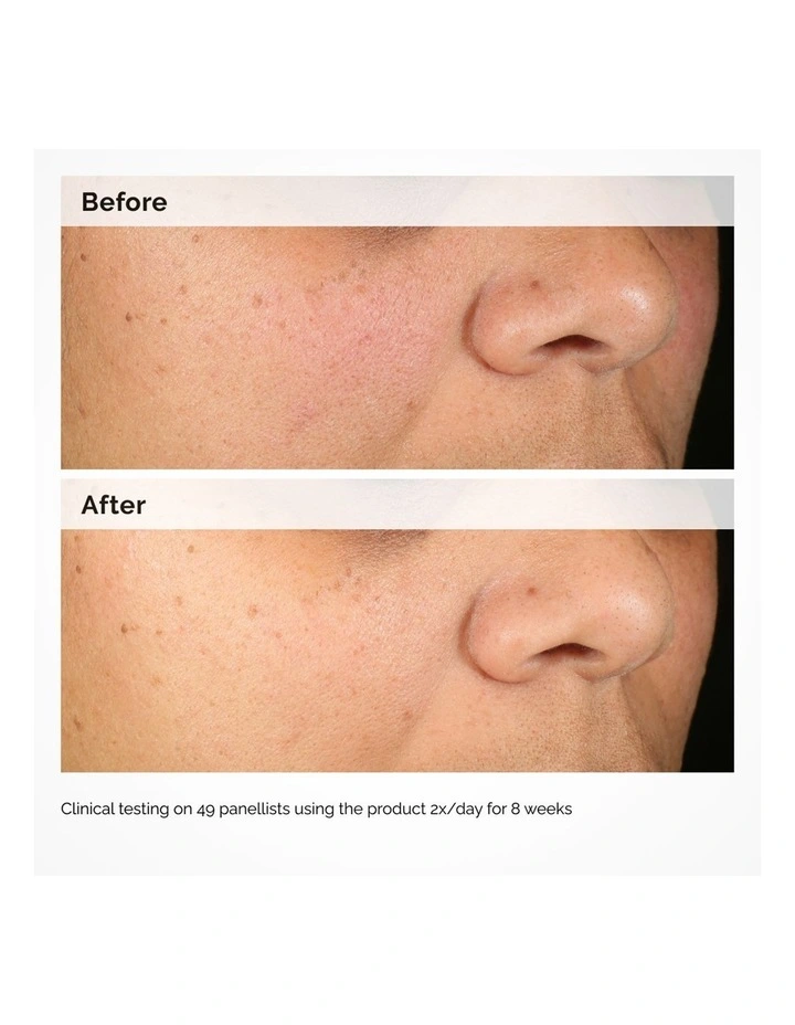 Alpha Arbutin 2% HA Hyperpigmentation Serum image 5