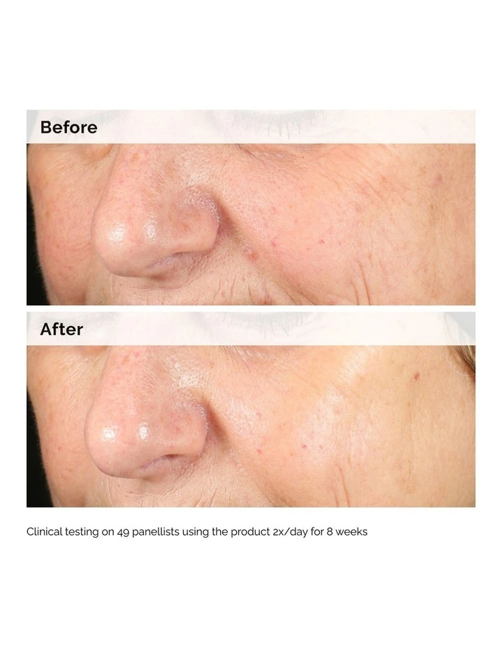 Alpha Arbutin 2% Hyaluronic Acid for Brightening and Dark Spots 30ml image 5