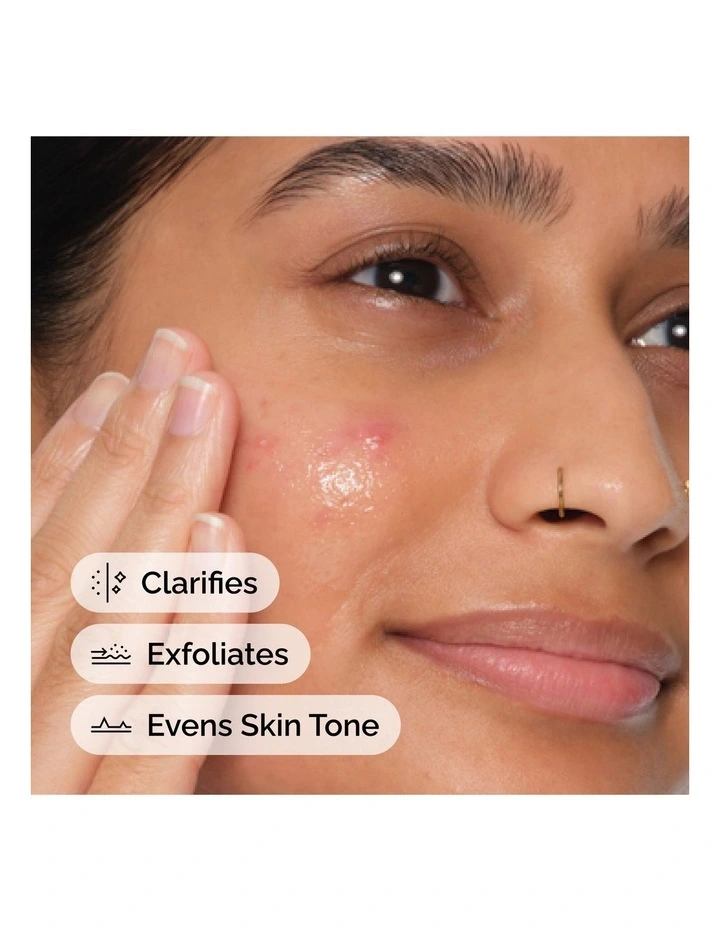 Salicylic Acid 2% Anhydrous Solution, Gentle Exfoliating Serum for Blemish-Prone Skin 30ml image 4