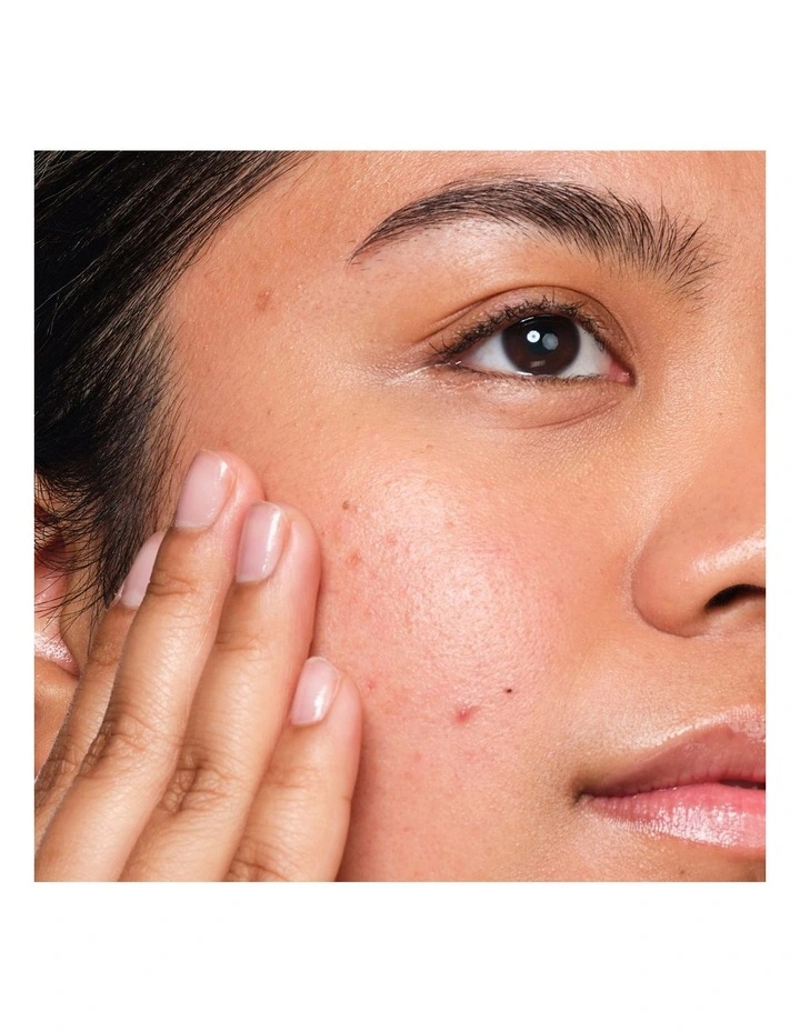 Salicylic Acid 2% Anhydrous Solution, Gentle Exfoliating Serum for Blemish-Prone Skin 30ml image 5