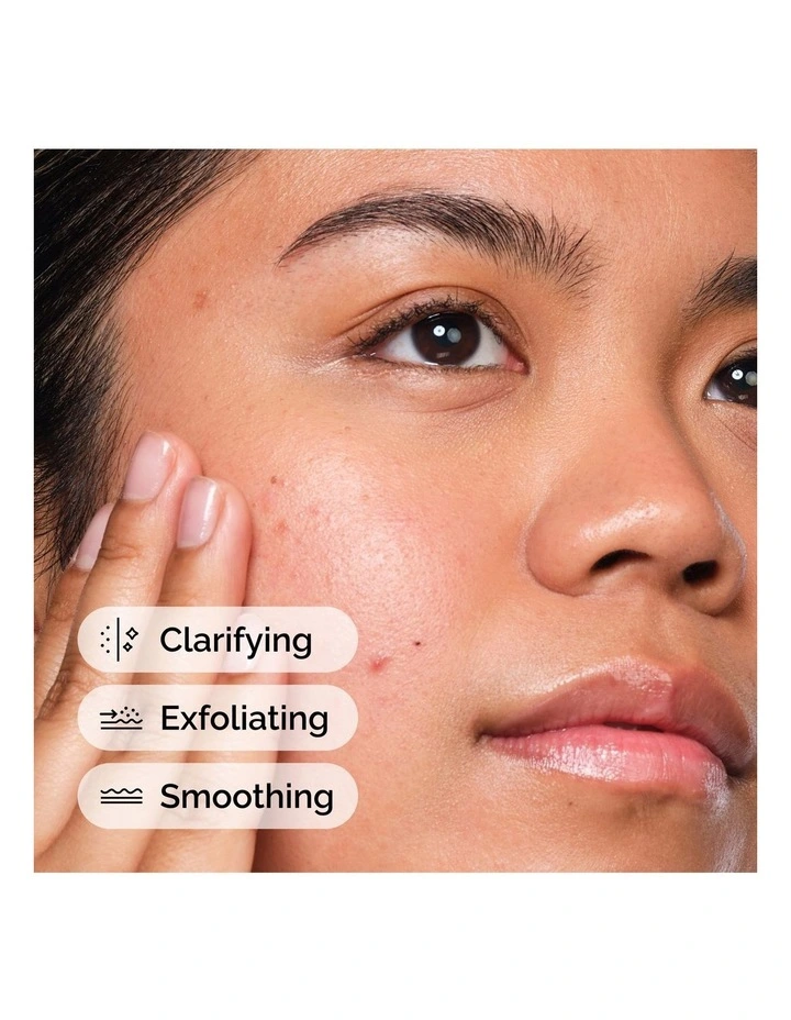Salicylic Acid 2% Solution 30ml image 4