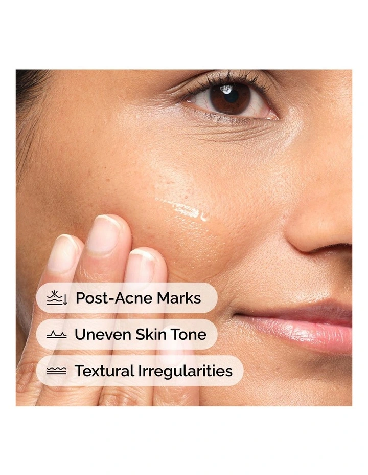Aloe 2%   NAG 2% Solution - Soothing and Lightweight Hydration for Post-Acne Marks 30ml image 4