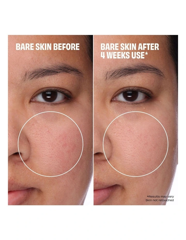 The Porefessional Foundation image 5