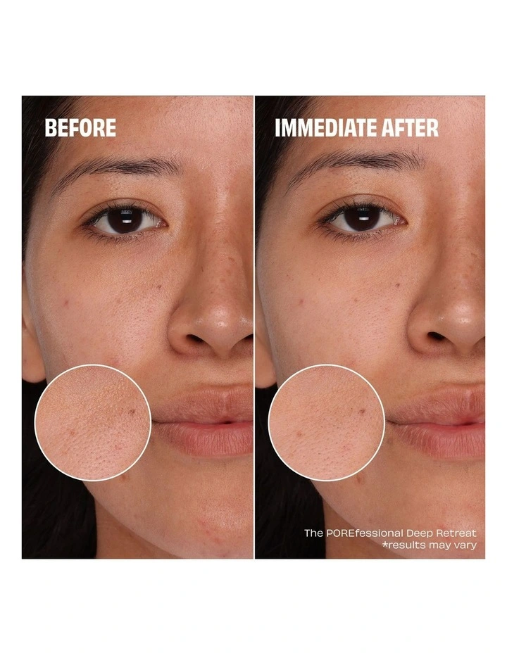 Connect Pore Mini Pore Trio image 3