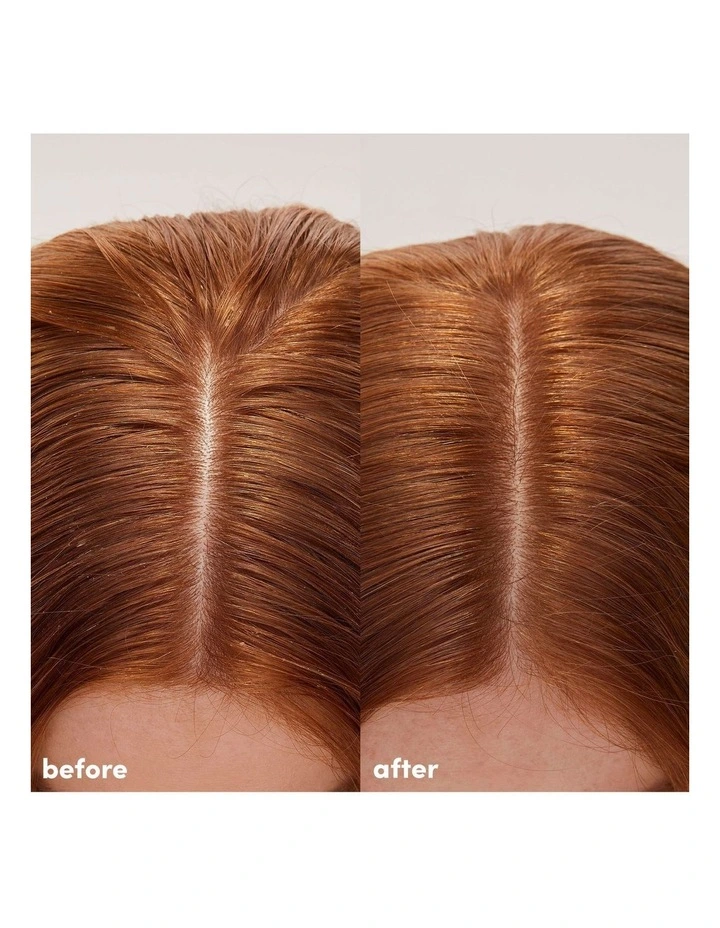 Clarifying Detox Shampoo 280ml image 4