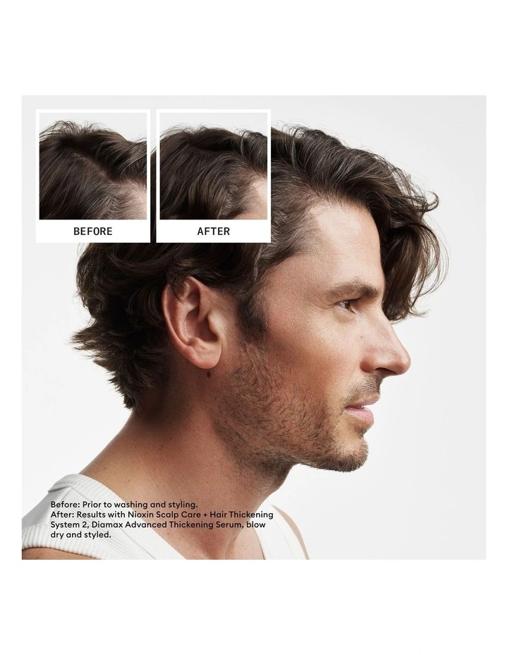 Scalp + Hair Thickening System 2 Full Size Kit image 4