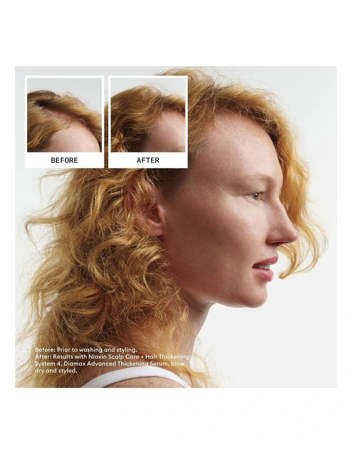 Scalp + Hair Thickening System 4 Full Size Kit image 4