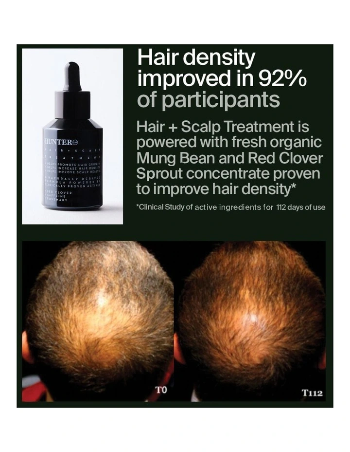 Hair and Scalp Treatment image 4