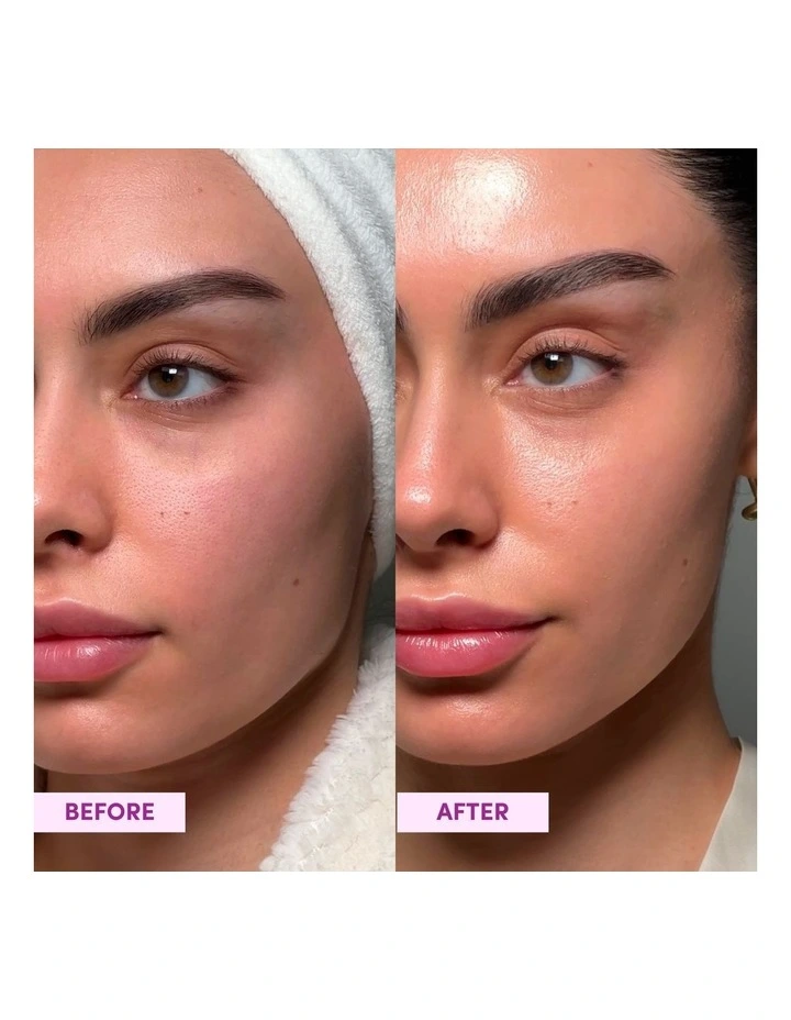 Australian Glow Berries Dreamy Glow Drops image 3