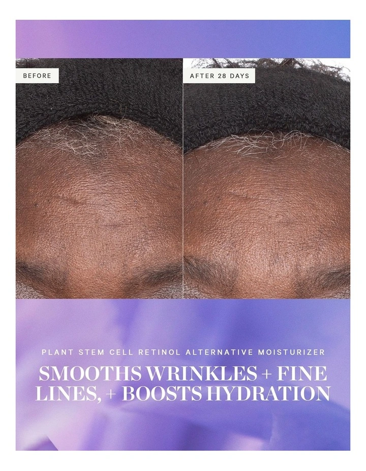 Plant Stem Cell Retinol Alternative Moisturizer image 3
