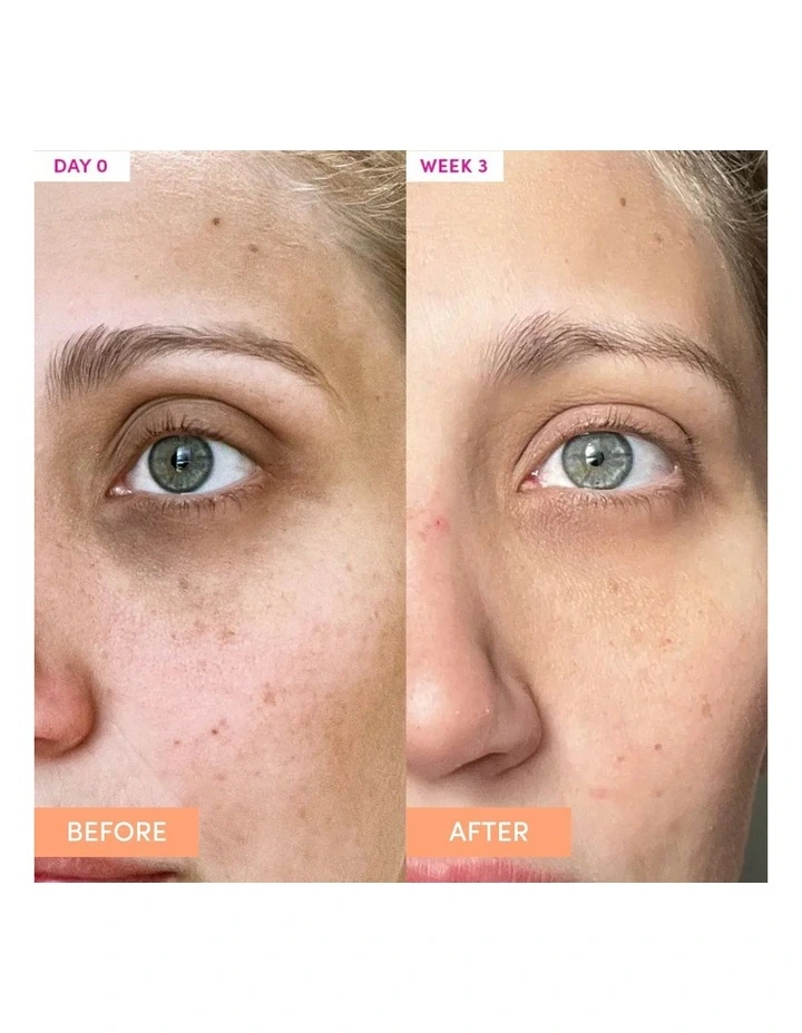 The Essentials Anti-Aging Eye Cream 20g image 3