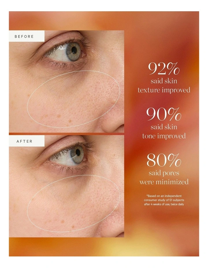 Turmeric Glow Drops Niacinamide Alternative Serum 30ml image 4
