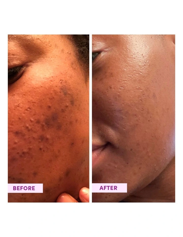 Australian Emu Apple Enzyme Powder Polish Exfoliant image 3