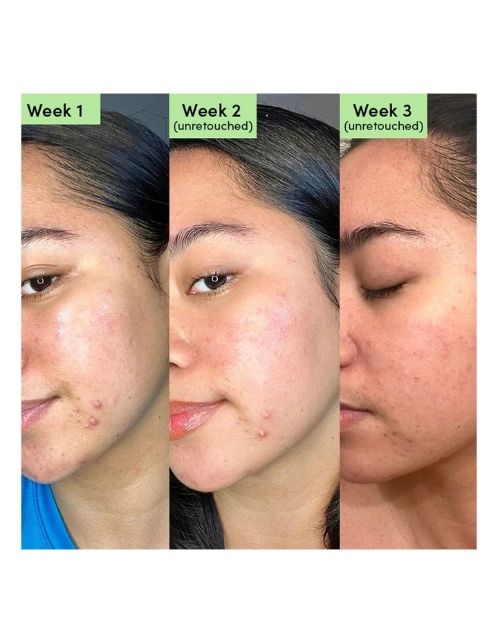 Oil Control Clearing Face Mask image 3