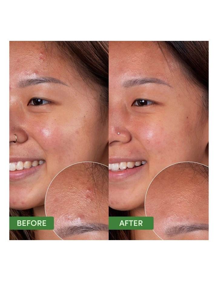 Oil Control Clearing Cleanser image 3