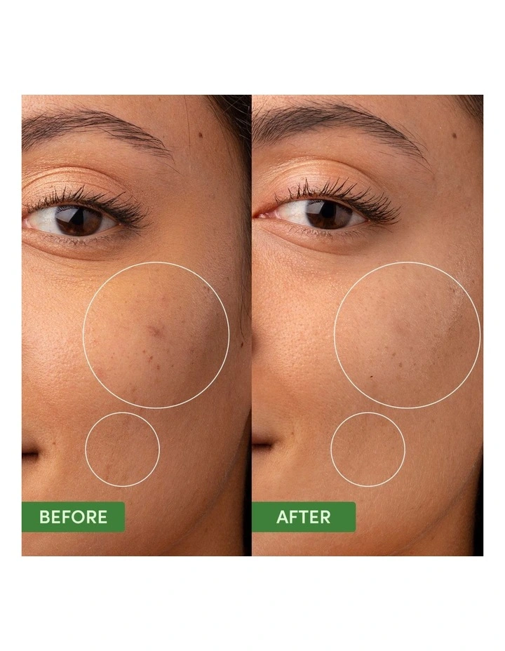 Oil Control Clearing Moisturiser image 3