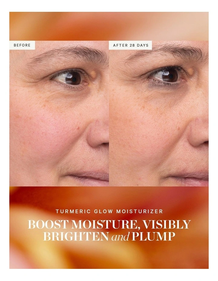 Turmeric Glow Moisturizer 15ml image 3