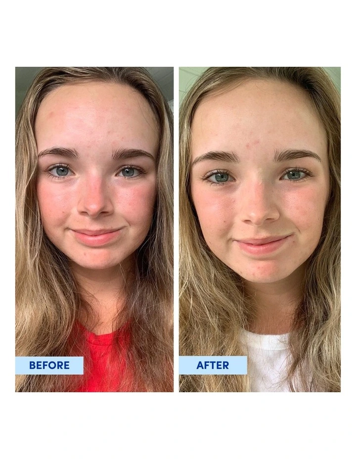 Travel Sized Tasmanian Spring Water Splash Serum image 3