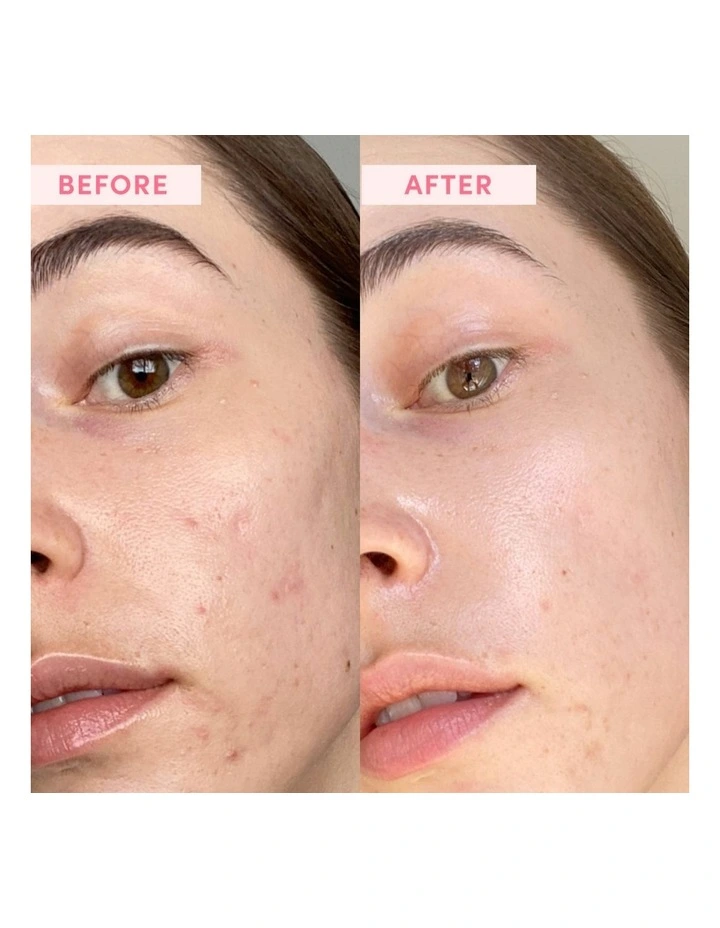 Australian Pink Clay Porefining Face Mask image 3