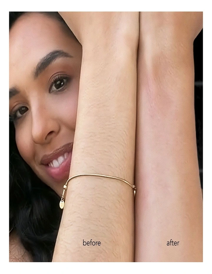 Exfoliating Hair Removal Drop image 5