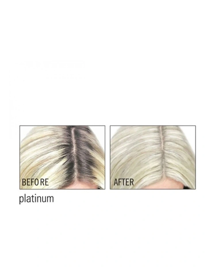 Root Cover Up image 4