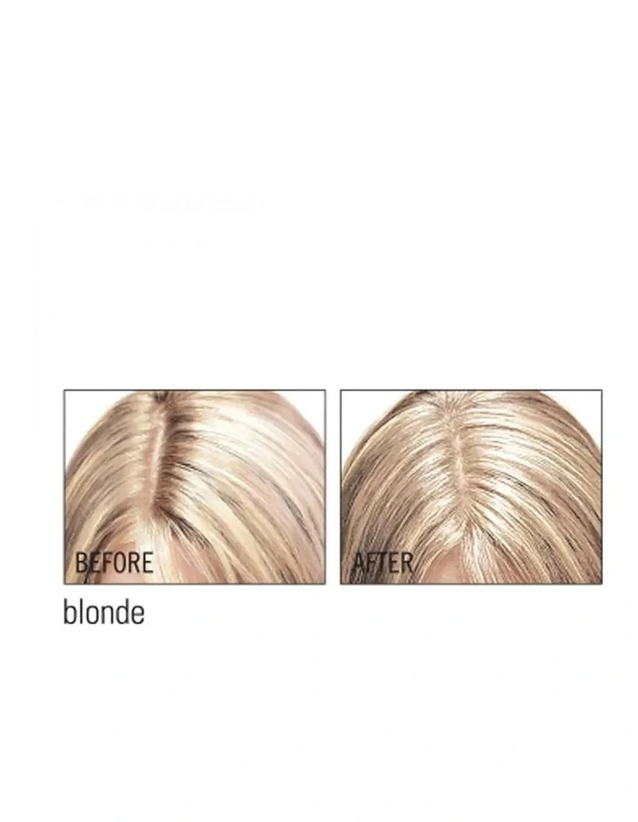 Root Cover Up image 4