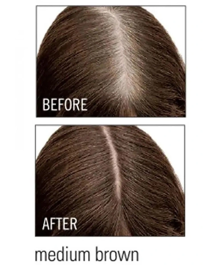 Root Cover Up image 4