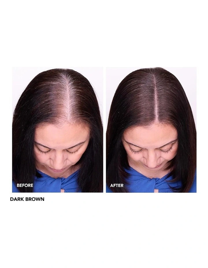 Root Cover Up image 4