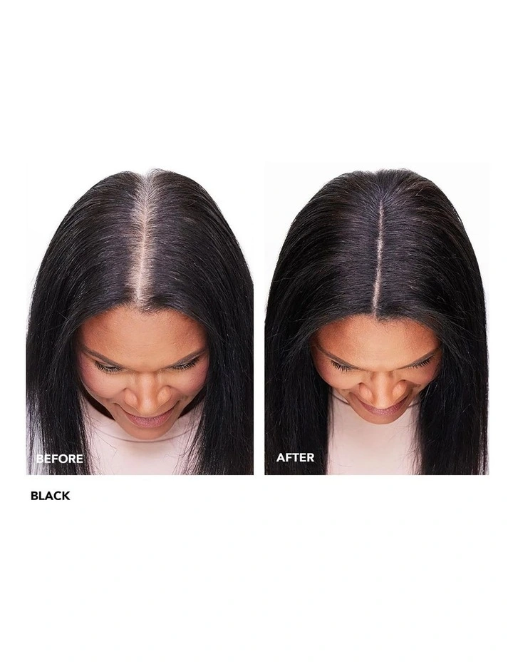 Root Cover Up image 4