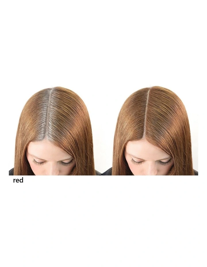 Root Cover Up image 3